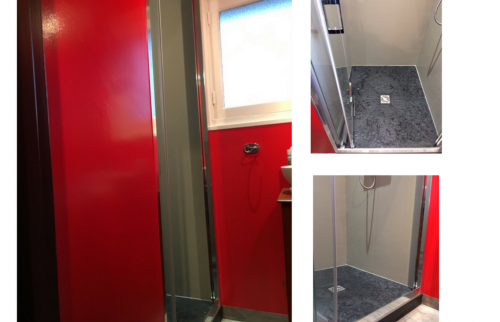 Vues du receveur  synthès gris ardoise